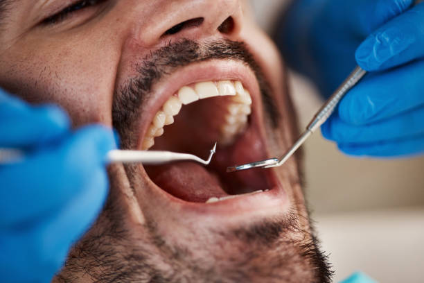 Best Emergency Dental Care for Abscessed Tooth in Salem Heights, OH